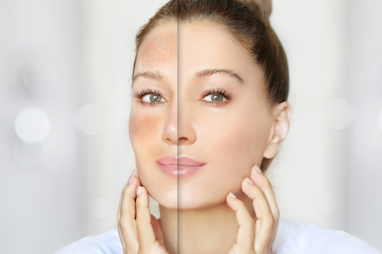 پوست خشک و دهیدراته؟ این روتین ساده، شما را شاداب می‌کند! 🌿